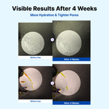Pacchetto NIDA Youthful Glass Skin